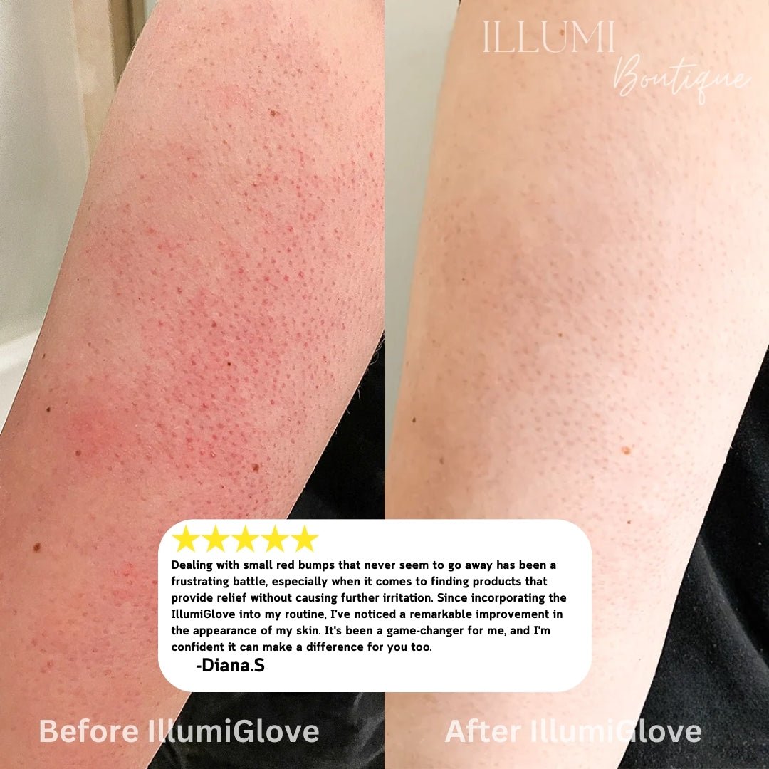 IllumiGlove Body Exfoliator - Illumi Boutique