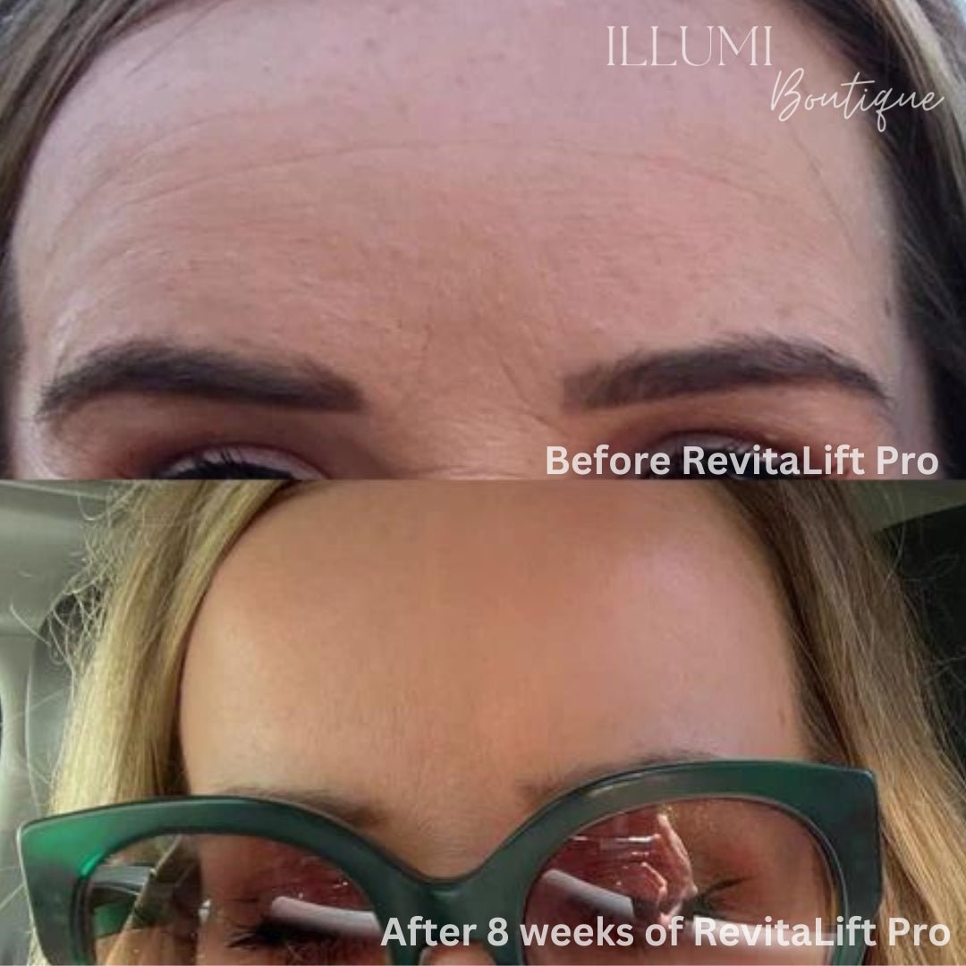 RevitaLift Pro Skin Sculptor - Illumi Boutique